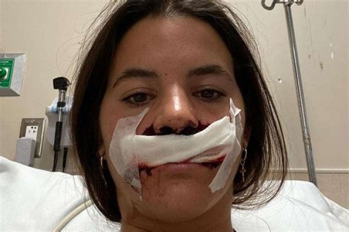 
Brooklinn Khoury Dog Attack – Was It An Accident? Injury Health Update And Age 