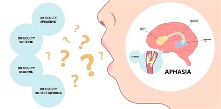 Did Bruce Willis Have A Stroke? What Is Aphasia? Actor Health Update And Family