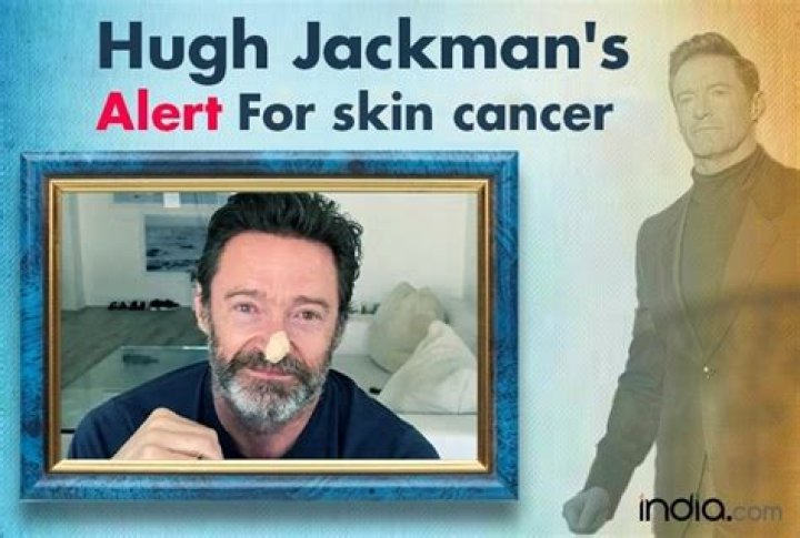 Hugh Jackman illness and Health Update is Hugh Jackman Sick? What illness Does Hugh Jackman Have? Does Hugh Jackman Have Skin Cancer?