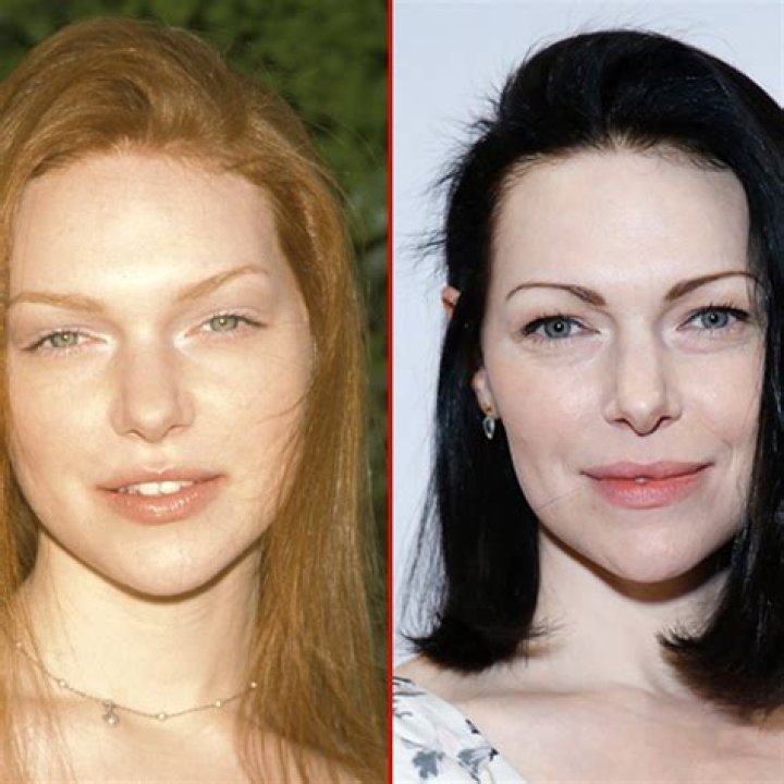 Laura Prepon Plastic Surgery That 90s Show And Current Looks