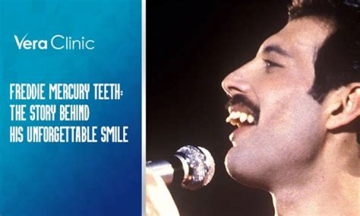Truth About Freddie Mercury’s Teeth That Gave Him His Unique Smile
